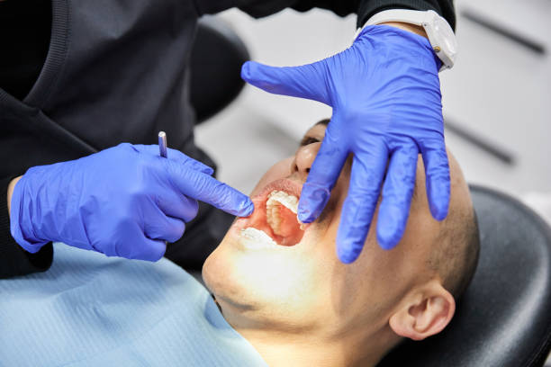 Best Urgent Care for Lost Fillings or Crowns in Shackle Island, TN