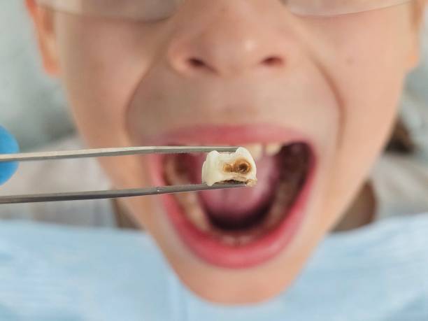 Best Emergency TMJ Treatment in Shackle Island, TN